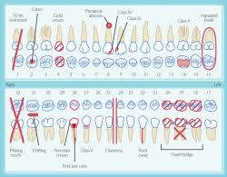 Dental Chart Forms Sada Margarethaydon Com