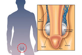 Image result for Varicocele