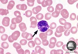 Rd.com knowledge facts there's a lot to love about halloween—halloween party games, the best halloween movies, dressing. Hematology Competency Assessment Trivia Questions Quiz Proprofs Quiz
