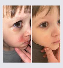 Healing Body Oil isn't just for us! It's also amazing for our fun furry  friends!! This is a review from my friend Shari… and pictures from other  customers using it