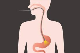 Cancer can have this effect by changing your metabolism, the way your body turns food into energy. Stomach Gastric Cancer Facts Symptoms Diagnosis Treatments