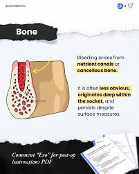 Image result for Post-Tooth Extraction Bleeding