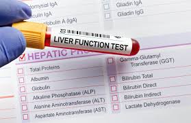 Image result for Liver Function Test