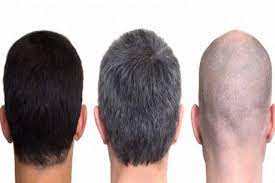 Larangan mewarnai rambut yang disebutkan dalam hadis adalah menyemir dengan warna hitam. Ini Hukum Mewarnai Rambut Dalam Islam Islampos