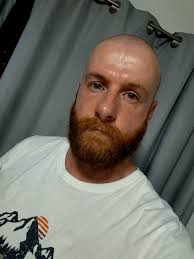 Bald ginger and proud 🤣 : r/bald