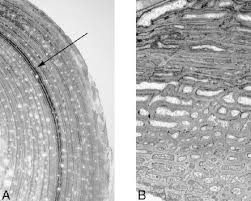 If you look at the cross section of a long bone under a microscope, the rings of bone immediately internal to the periosteum of the bone are called _____. A Photomicrograph Of Cross Section Of Crocodilian Long Bone Showing Download Scientific Diagram
