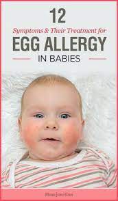 Egg Allergy Is Common In Babies Whose Immune System Has Not Developed To Sustain Protein Content Present Egg Allergy Kids Allergies Milk Allergy Symptoms Baby