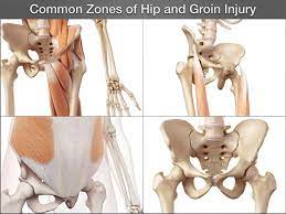 Meaning, pronunciation, synonyms, antonyms, origin, difficulty, usage index and more. Top Exercises For Groin Rehabilitation And Injury Reduction