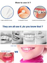 A good wax is unlike other waxes. 5pcs Oral Hygiene Fawnmum Dental Care Braces Gum Protective Wax Orthodontitics Wax Gum Irritation Wax Depilatory Gum Damgum Paste Cake Decorating Aliexpress
