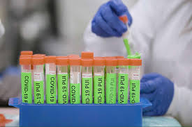 UC Berkeley to test 5,000 healthy people in East Bay for coronavirus