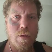 Aaron Raschke's Instagram, Twitter & Facebook