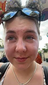 I just want to say to the lady that sprayed me in the eyes with the aerosol  sunscreen in the security entrance line. I know you didn't mean to, but you  hurrying