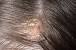 Hard Water Build Up Hair