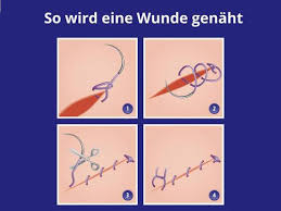 Bei kleineren wunden können sie das selbst übernehmen Wie Sie Mit Einer Wunde Richtig Umgehen Sollten