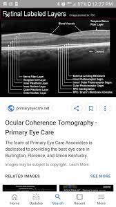 Our offices in brentwood, spring hill and columbia want to help you achieve and maintain clear vision for years to. 630 Eye Doc Stuff Ideas In 2021 Optometry Eye Health Eye Facts