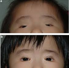 Image result for Blepharis transvaalensis