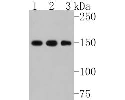 Collagen III Recombinant Rabbit Monoclonal Antibody [JE60-79] (HA72005 –  HUABIO