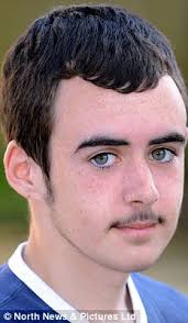 Use a damp cloth to gently wipe off the cream and remove unwanted hair. Teenager With Skin Problem That Prevents Shaving Expelled From School For Having A Moustache Daily Mail Online