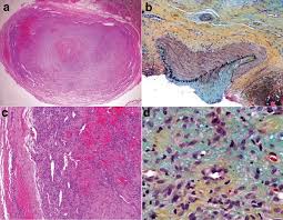 Image result for Pseudoeriosema