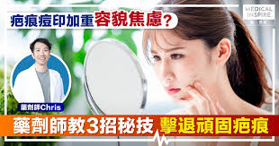 疤痕痘印加重「容貌焦慮」？藥劑師教3招秘技擊退頑固疤痕 ...
