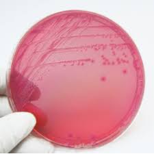 E Coli Infections What You And Your Family Need To Know Montreal Children S Hospital