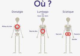 C'est mécanique ou inflammatoire ? Type De Douleurs Du Dos Et Comment Les Soulager