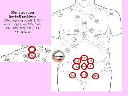 Amenorrhoea Lack Of Periods Hijama Cupping Points Hijama Points