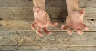 Namun meski begitu jika terjadi konon katanya antara jika telapak tangan kanan dan kiri yang gatal artinya bisa berbeda. Telapak Tangan Gatal Bukan Nak Dapat Atau Keluar Duit Tapi Ini Faktornya