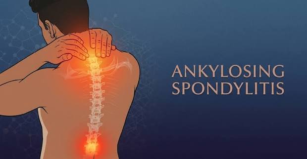 Sciatica symptoms