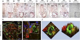 (pzp) is an immunocontraceptive that is used to control the reproductive rate of some mammalian species, including horses, deer and elephants. Immunolocalization Of Pzp In The Human Preterm Placenta A C Download Scientific Diagram