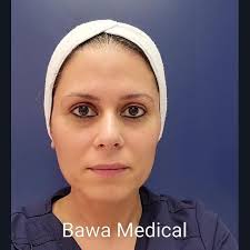 Lymphatic Drainage With Platinum HydraFacial