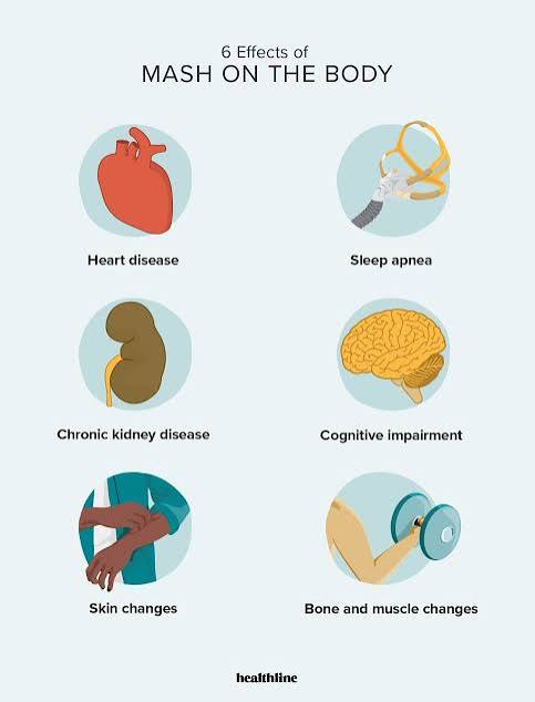 How MASH Affects the Body