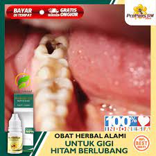 We did not find results for: Obat Sakit Gigi Paling Cocok Untuk Gigi Berlubang Gigi Ngilu Gigi Goyang Gigi Sensitif Gigi Sakit Gigi Bengkak Gusi Bengkak Berdarah Untuk Anak Dan Dewasa Dengan Propolis Sm 100 Lazada Indonesia