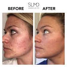 Pin On Before After
