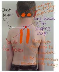 Pin On Kids Love Acupuncture