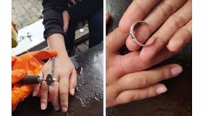 Iya butul.jari manis adalah 薬指. Solusi Cincin Kawin Kekecilan Bikin Jari Sakit Ada Kasus Sampai Menempel Kulit Cantik Tempo Co