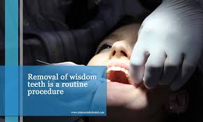 44 years experience oral and maxillofacial surgery. Wisdom Teeth Removal 11 Recovery Tips