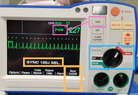 Image result for Synchronized Cardioversion