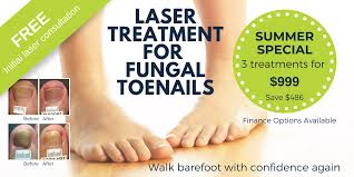 fungal nail infection treatment laser