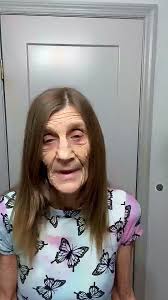 Cheryl Skin Condition