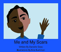 Me and My Scars by Danielle Goss
