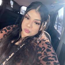 We are back home everything is fine 🙏, we were so scared for her eyesight  but she was protected, cause it was a 3 prong hook, and her eyesight was  not impaired