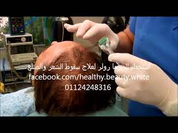 ربيع إبريق بشرة ديرما رولر للشعر تجربتي buyandsellnapleswithnancy com
