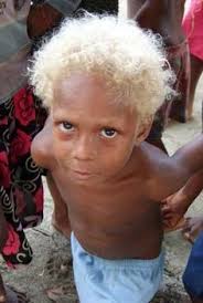 Melanesian Melanesian People Black And Blonde People