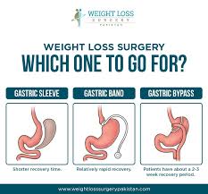Pin On Weight Loss Surgery Pakistan