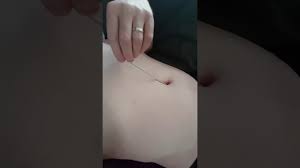 Sotica belly piercing kit with 14g stainless steel piercing needle belly botton piercing kit navel piercing kit with piercing clamps piercing jewelry for body piercing supply (silver) 4.4 out of 5 stars. Navel Stab With Knitting Needle Youtube