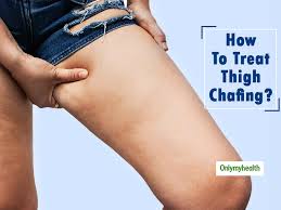 Thighs are the most common skin area for the boils to occur. Avoid Thigh Chafing With These 7 Home Remedies