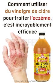Epingle Sur Remedes Naturels