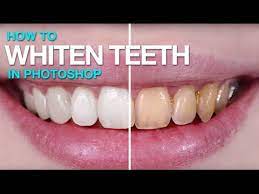 How to whiten teeth in photoshop. How To Whiten Teeth In Photoshop Youtube