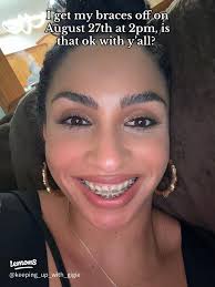 Braceface Journey: Tips, Style, and Support for Life with Braces